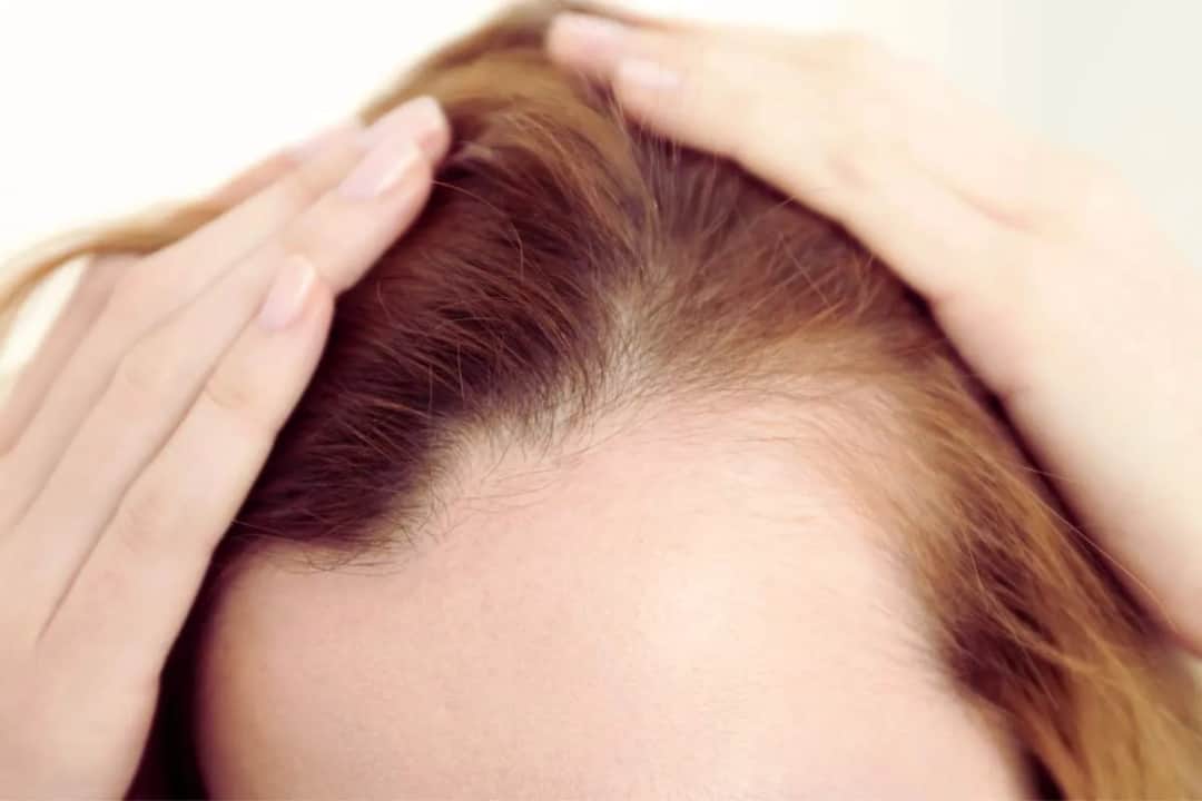 Zatrzymaj wypadanie włosów! Diagnoza, dieta, pielęgnacja ekspert radzi